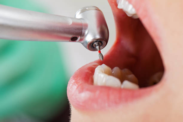 Best Emergency Dentist for Knocked-Out Tooth in Hollandale, MS